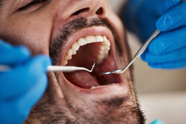 Best Pediatric Emergency Dentist in Woodbury, NY